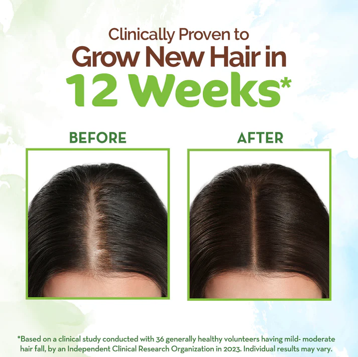 Mamaearth Rosemary Hair Growth Oil – 150ml - Image 5