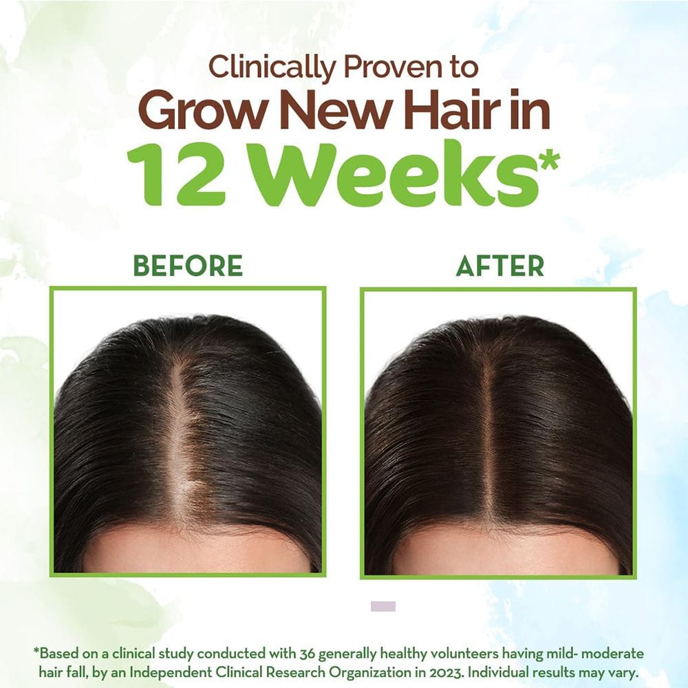 Mamaearth Rosemary Anti-Hair Fall Shampoo – 250ml - Image 3