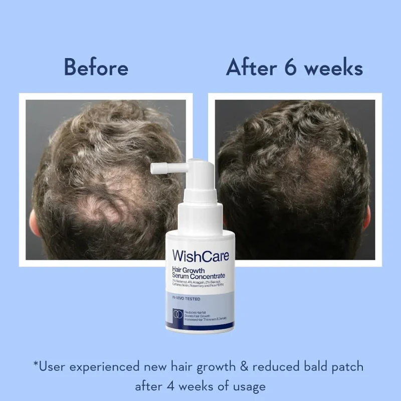 WishCare Hair Growth Serum Concentrate – 30ml - Image 3