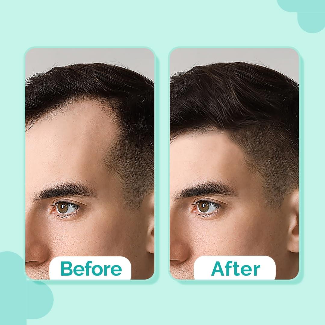 The Derma Co 20% Actives Peptide Hair Growth Serum – 30ml - Image 6